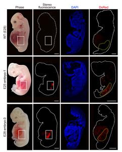 Humanized kidney cells