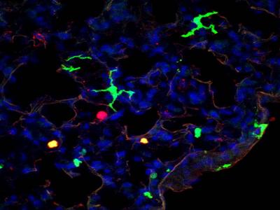 Newly Discovered CD11b+ Dendritic Cells Uncover Target for Better Vaccine Design