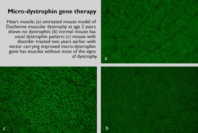 Comparison of Untreated and Treated Dystrophic Muscles