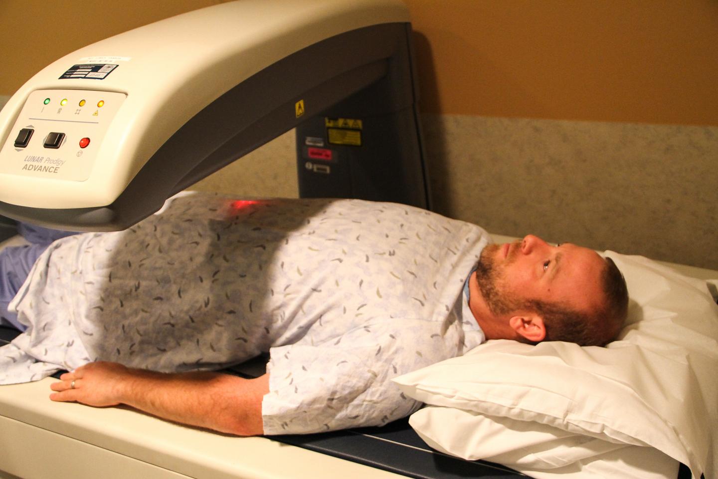 Push for Men to Be Included in Osteoporosis Screening Guidelines