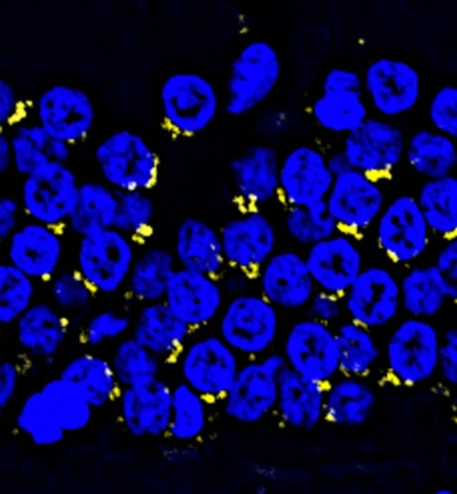 Tick tock in the brain: Chinese scientists provide molecular insights into primate hippocampal aging