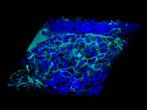 Cystic fibrosis: restoring airway integrity