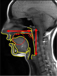 Main anatomical shape factors of the vocal tract