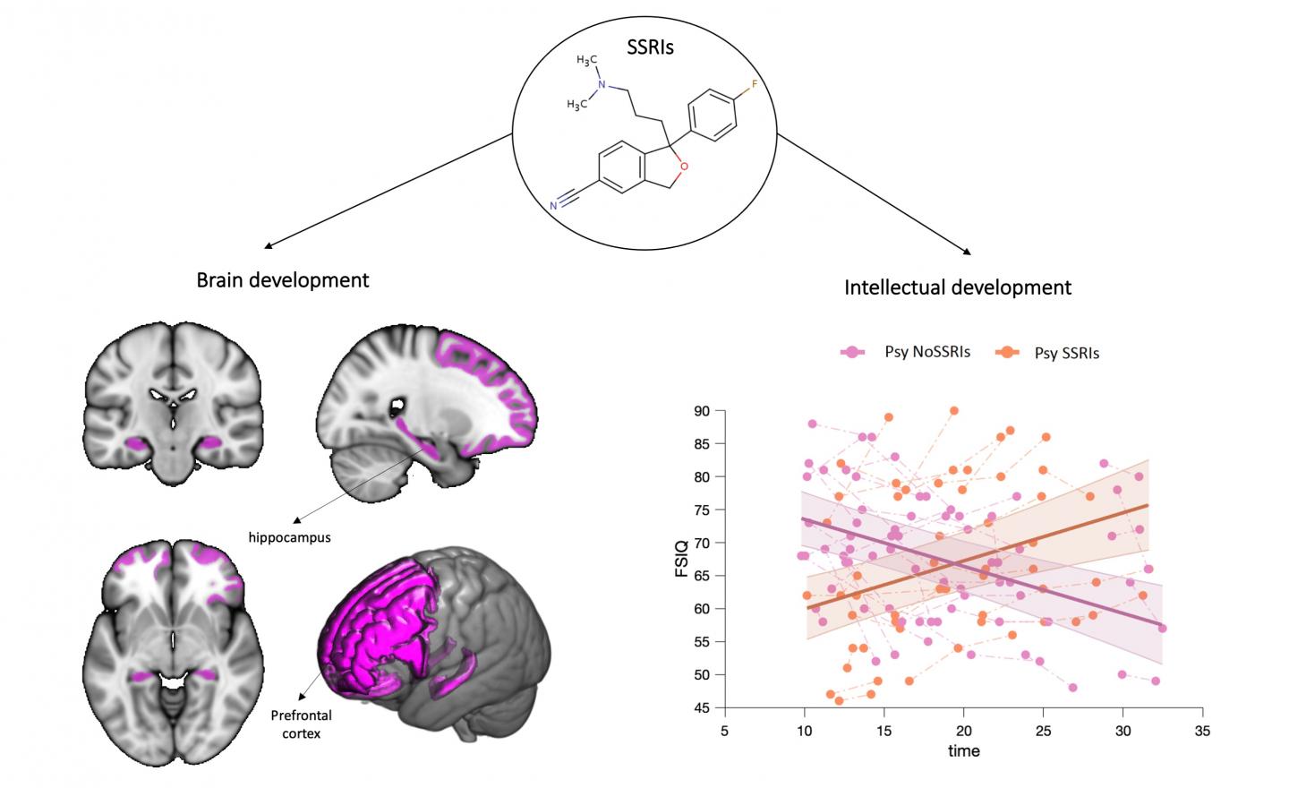 Effets des ISRS sur le développement cérébral et intellectuel. A gauche : carte du cerveau montrant les régions du cerveau protégées par l'administration prolongée d'ISRS comprenant un réseau de sructures préfrontales et limbiques. À droite : graphique mo