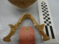 Teeth from the Middle Ages (2 of 2)