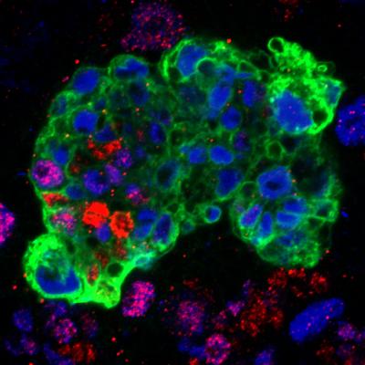 Ectopic Neural Stem Cells