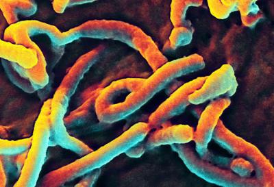 Ebola Virus Budding From a Cell