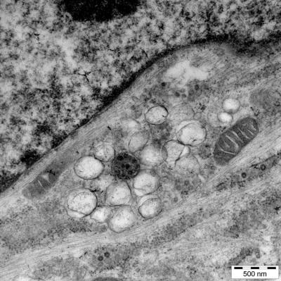 Cluster of Vesicles Made by Virus