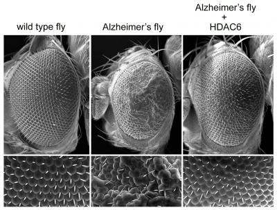 Cell’s Protein Recycling Systems Linked