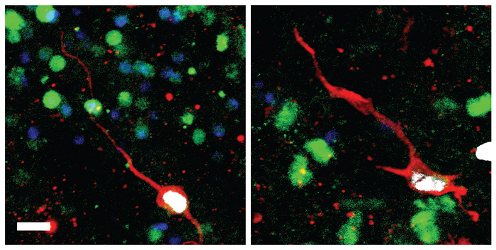 Newborn immature dentate granule neurons