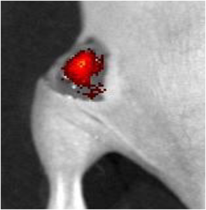 Fluorescent spray lights up tumors for easy detection during surgery