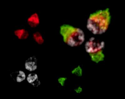 <I>C. elegans</I> Sperm (2 of 2)