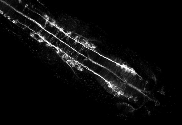 In Killifish: Diapause Protects Life From Normal Consequences of Aging (11 of 14)