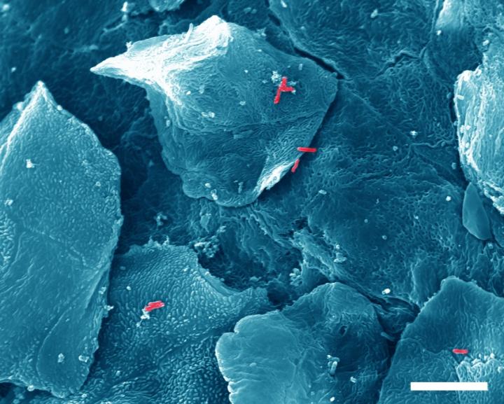 Fatal Attachment: How Pathogenic Bacteria Hang on to Mucosa and Avoid Exfoliation