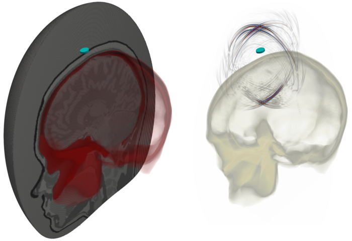 Imaging The Brain With Ultrasound Waves Eurekalert