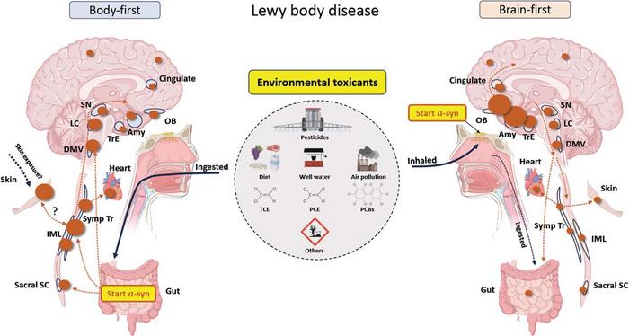 New Model of How Environmental Toxicants May Trigger Parkinson's Disease
