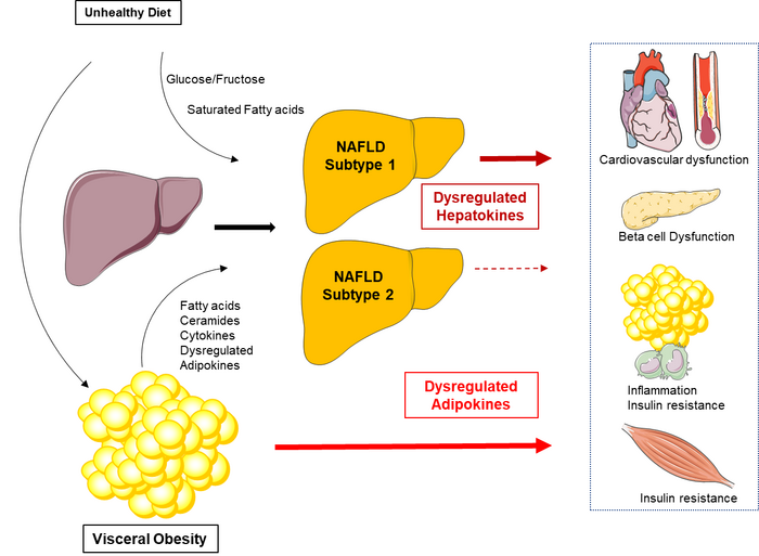 nafld