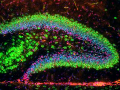 Dendate Gyrus of the Mouse Hippocampal Formation