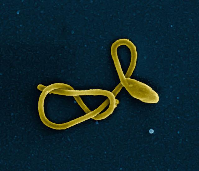 Ebola Virus Particle