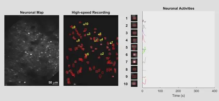 Calcium Imaging Video