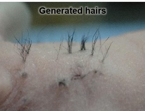Laboratory Study Paves Way for New Approach to Treating Hair Loss in Humans