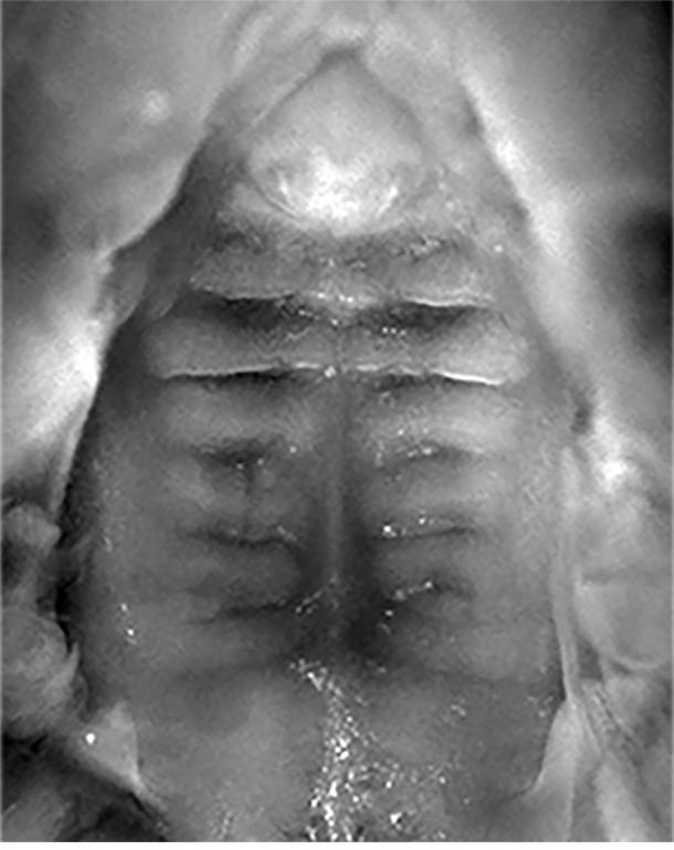 Normal Palate Formation [IMAGE] EurekAlert! Science News Releases