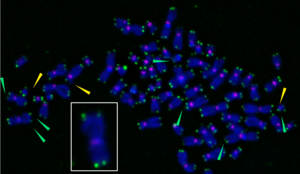 Fragile telomeres