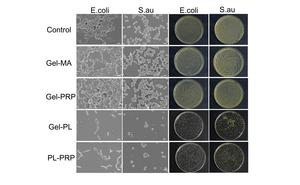 To create a new wound-care gel, researchers used a common hydrogel, Gel-MA, and created several combinations infused with platelet-rich blood plasma (PRP) and polylysine (PL). To test the gel’s ability to battle bacteria, they added E. coli and S. aureu