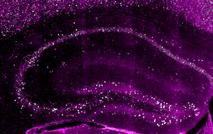 The brain creates three copies for a single m