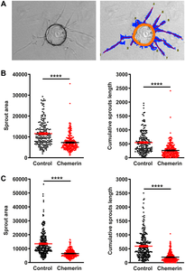 Myo1g over expression is conserved at protein level in acute lymphoblastic leukemia