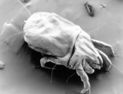 A Between-the-Covers Exposé of House Dust Mites