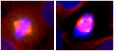 CHFR Gene Regulates Mitotic Spindle