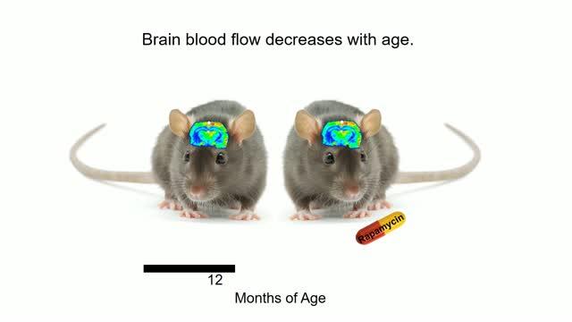 Rapamycin Preserves Brain Blood Flow, Memory during Aging