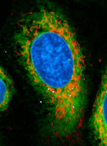 Human monocyte derived macrophages incubated with Legionella pneumophila