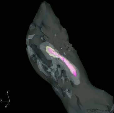 A Recipe for Early, Massive Black Hole Formation (5 of 7)