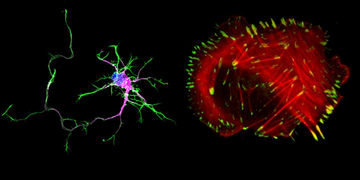 Image Showing How Different Neurons and Cancer Cells Are by their Morphology