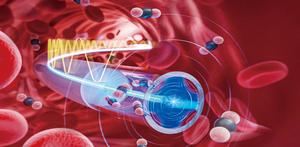 Fiber photoacoustic spectrometer enables continuous intravascular gas monitoring.