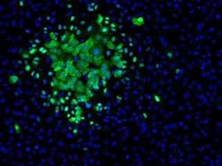 Influenza A Infection in Cell Culture