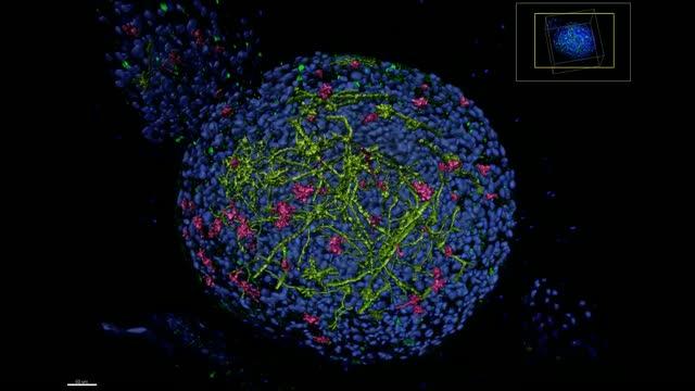 Peeking inside 3D human 'mini-brains' to understand the brain