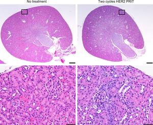 Images of nontreated control and mouse treated with 2 cycles of HER2 225Ac-PRIT