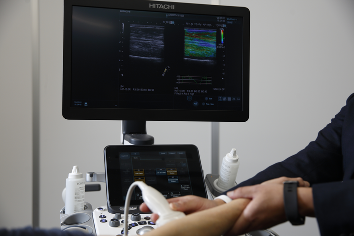 An example of ultrasound imaging in sports sciences