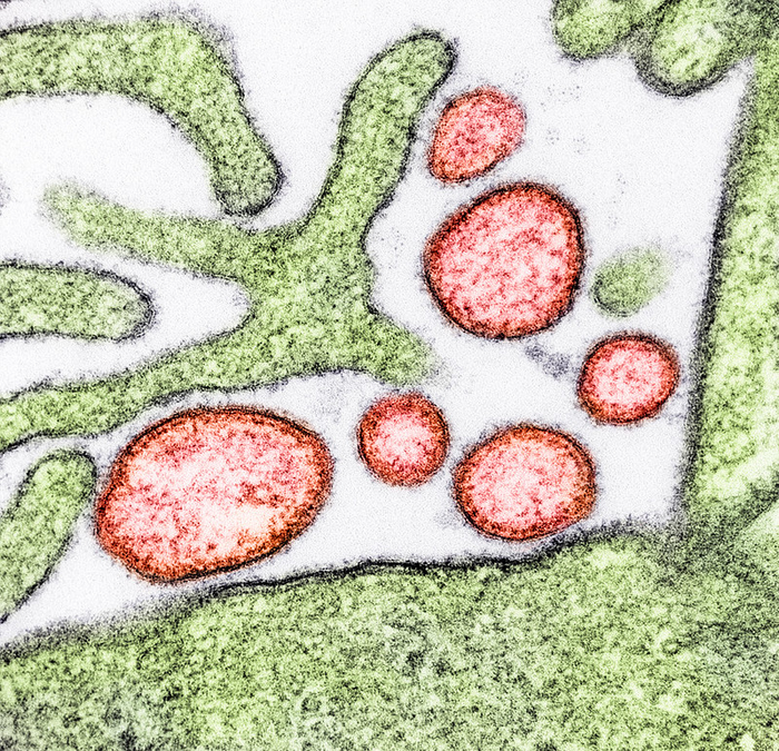 Nipah Virus particles