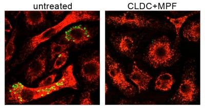 Tularemia Bacteria and Mouse Macrophages
