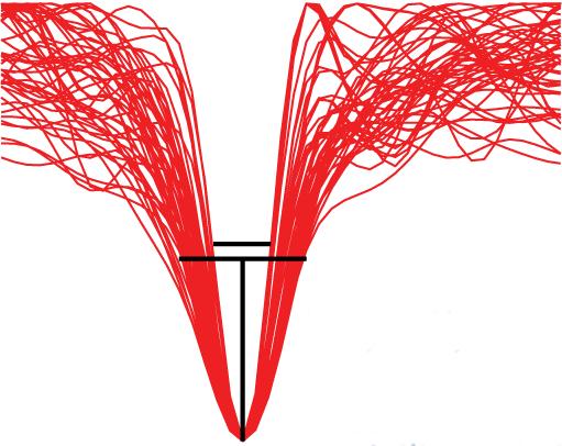 Seizures Begin with a Muffle