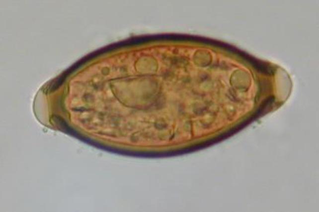 Helminth Infections Common in Medieval Europe, Grave Study Finds