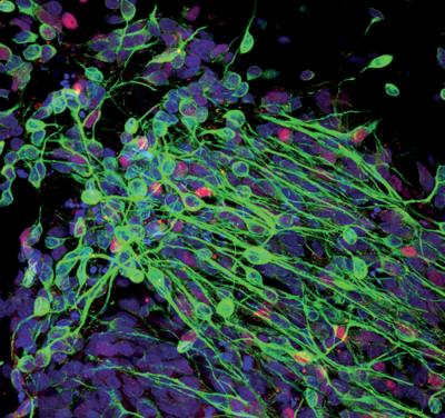 Neurons Derived from Cord Blood Cells may Represent New Therapeutic Option
