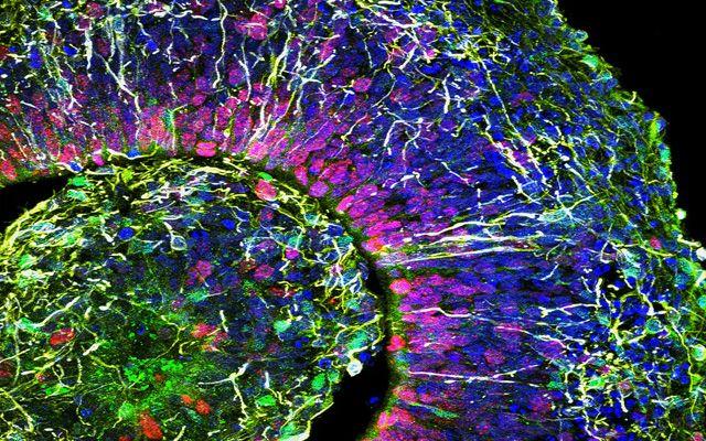 ASD Organoid, UC San Diego School of Medicine