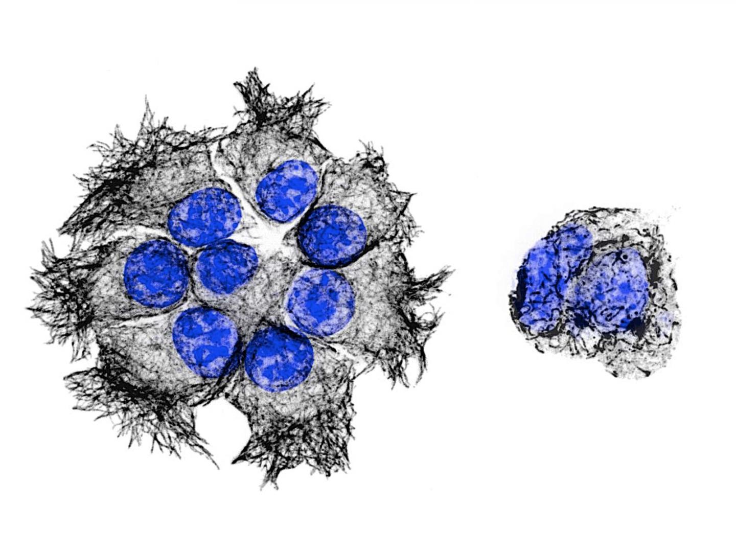 Pancreatic Cancer Cells