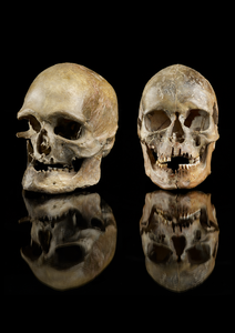 Male and female skull buried in western Germany (Oberkassel)