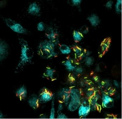 Macrophages Infected with <i>Mycobacterium tuberculosis</i>